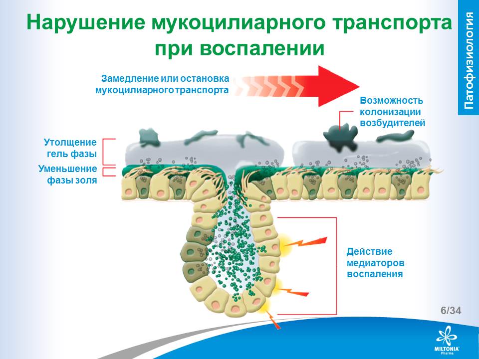 slide_6